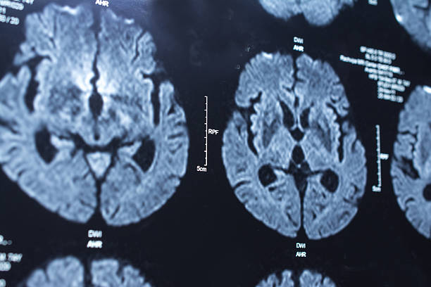 pesquisa em medicina. ct scan do paciente. - medical equipment mri scanner mri scan hospital - fotografias e filmes do acervo