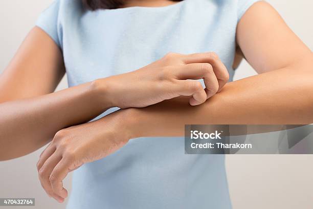 Itching Stock Photo - Download Image Now - Scratching, Dry, Women