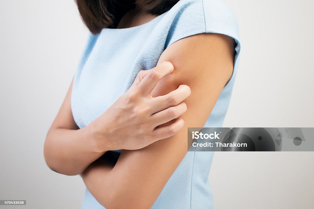 Woman wearing a blue dress scratching her arm Scratching in A Woman Ringworm Stock Photo