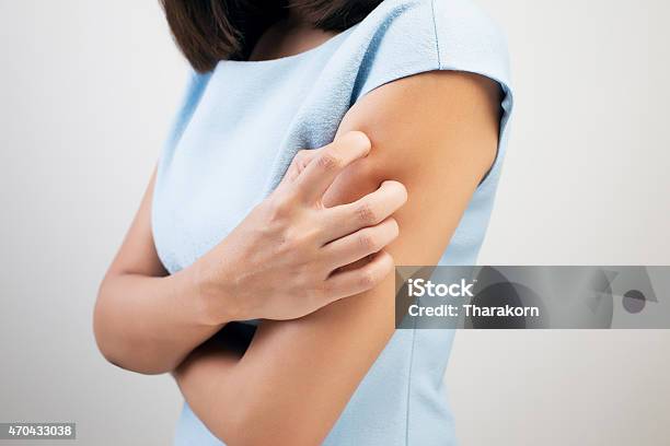 Woman Wearing A Blue Dress Scratching Her Arm Stock Photo - Download Image Now - Ringworm, Scratching, Women