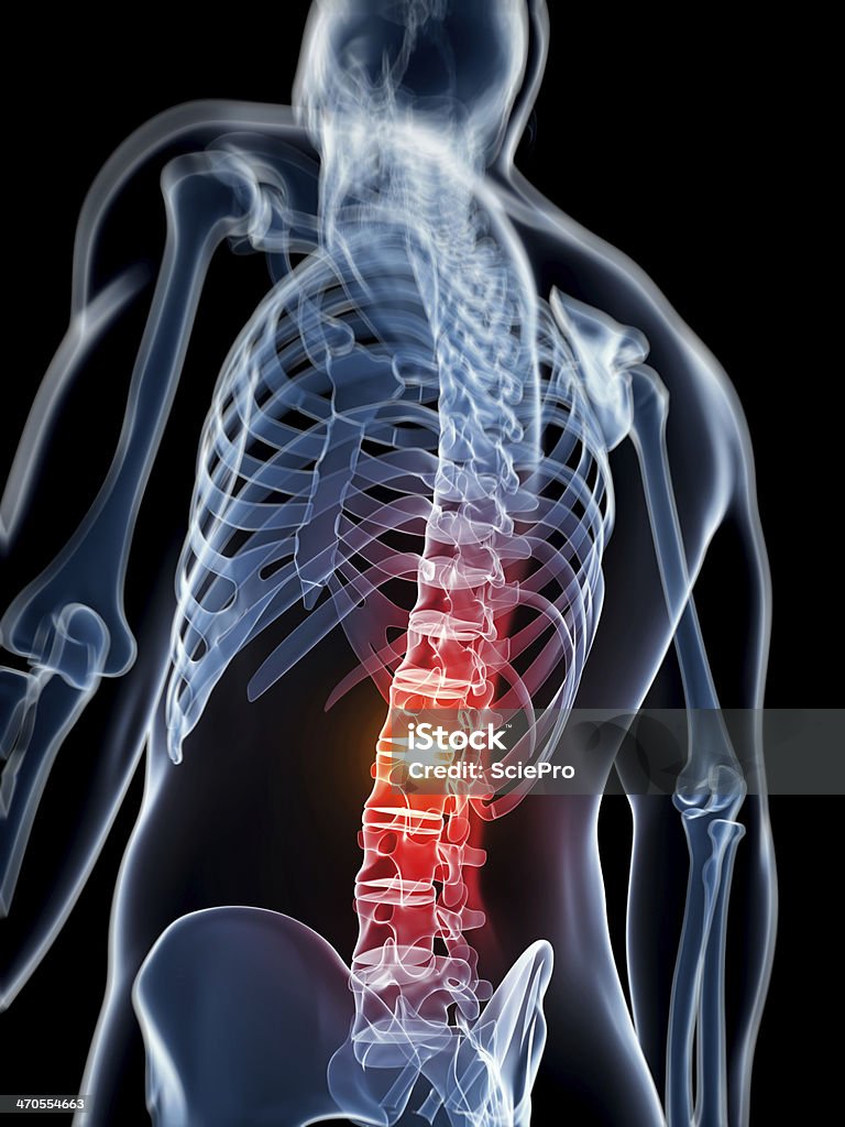 男性が急性痛のバック - 3Dのロイヤリティフリーストックフォト