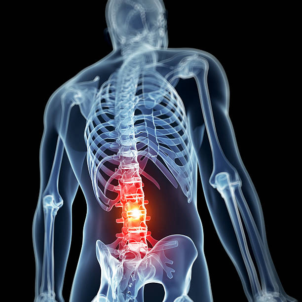 X- ray of man showing in red where he's having acute pain stock photo
