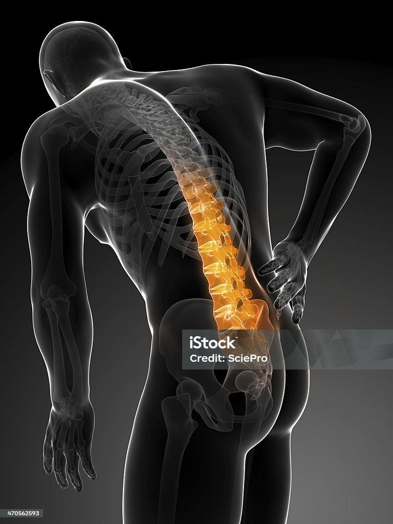 Homem com dor nas costas graves - Foto de stock de Anatomia royalty-free