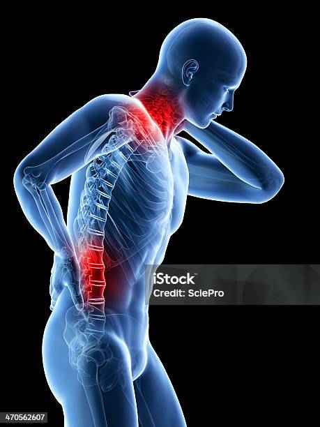 Man Having Acute Pain In The Back Stock Photo - Download Image Now - Anatomy, Arthritis, Back