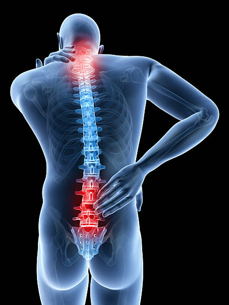 istock X-ray type image of a man with acute neck and back pain 470562637
