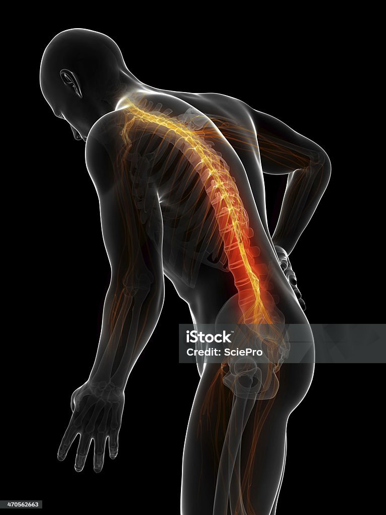 Hombre con dolor agudo, en la parte posterior - Foto de stock de Anatomía libre de derechos