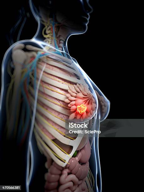 Nowotworu Piersi - zdjęcia stockowe i więcej obrazów Anatomia człowieka - Anatomia człowieka, Bez ludzi, Biologia - Nauka