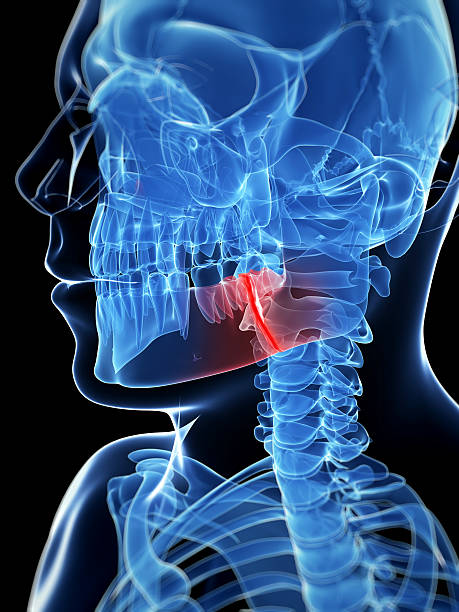 istock Blue X-ray silhouette of a broken jaw 470569093