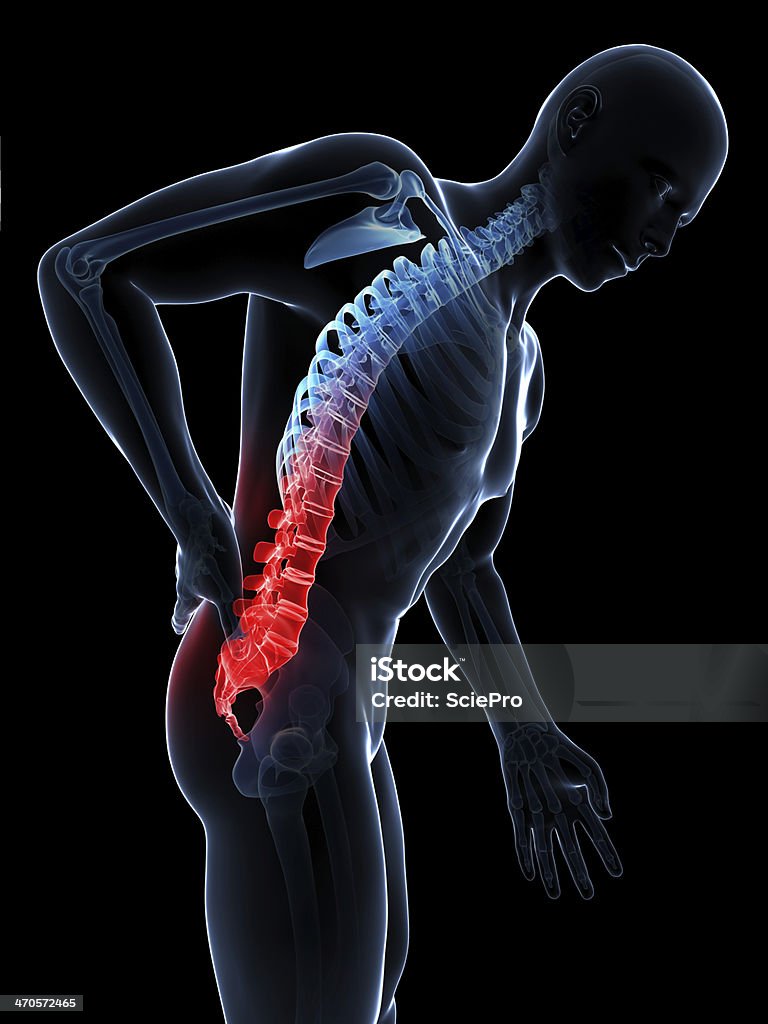 Homem com dor nas costas graves - Foto de stock de Anatomia royalty-free