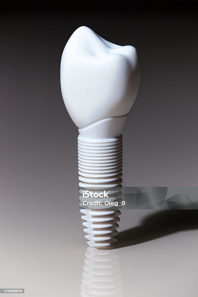 Models of dental, implants Models of dental, implants, dental dentist objects implants  2015 Stock Photo