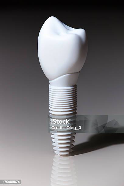 Models Of Dental Implants Stock Photo - Download Image Now - 2015, Anatomy, Beauty Product
