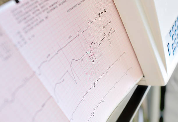 istock printing of the electrocardiogram. 470647760