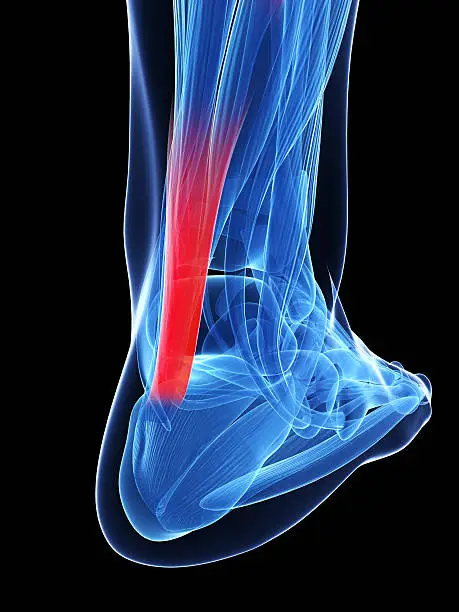 Photo of achilles tendon