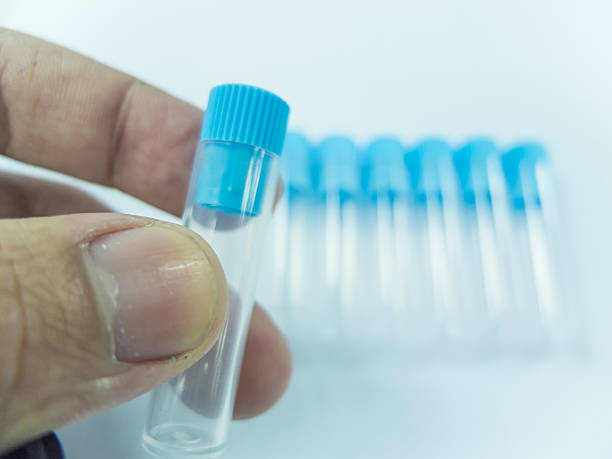 istock Hand holding a blue test tube 470720325