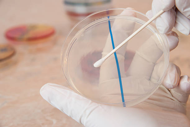 istock Sterile swab and petri dish agar 470744342