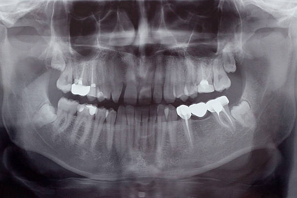 人間の歯、x 線 - radiologist cat scan x ray cat scan machine ストックフォトと画像