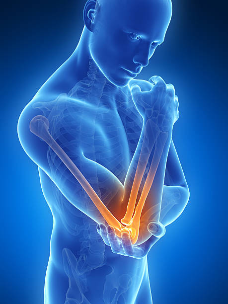 istock A see through image outlining pain in the elbow 470798593