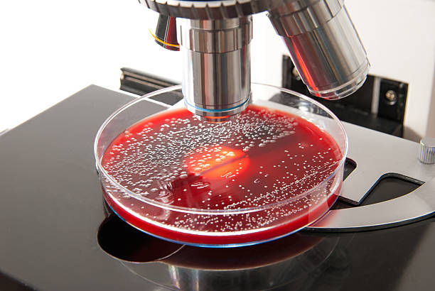 petrischale mit escherichia colli bakterien auf mikroskop hintergrund - blood agar stock-fotos und bilder