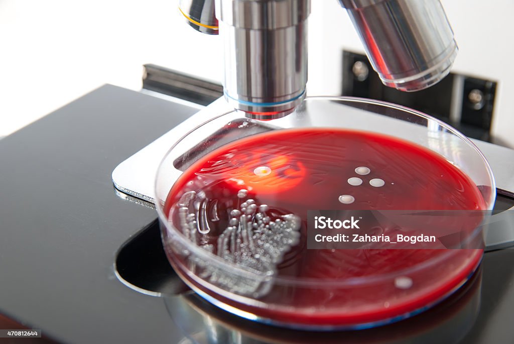 Microscope aimed at petri dish with bacteria colonies Bacteria colonies on petri dish under the light of the microscope 2015 Stock Photo