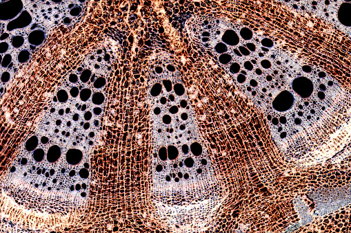 Microscopic Image of the plant Aristolochia sipho (