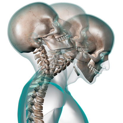 X-ray of a human head showing a example of contortion: the neck bending back and forward. Side view, isolated on white background.