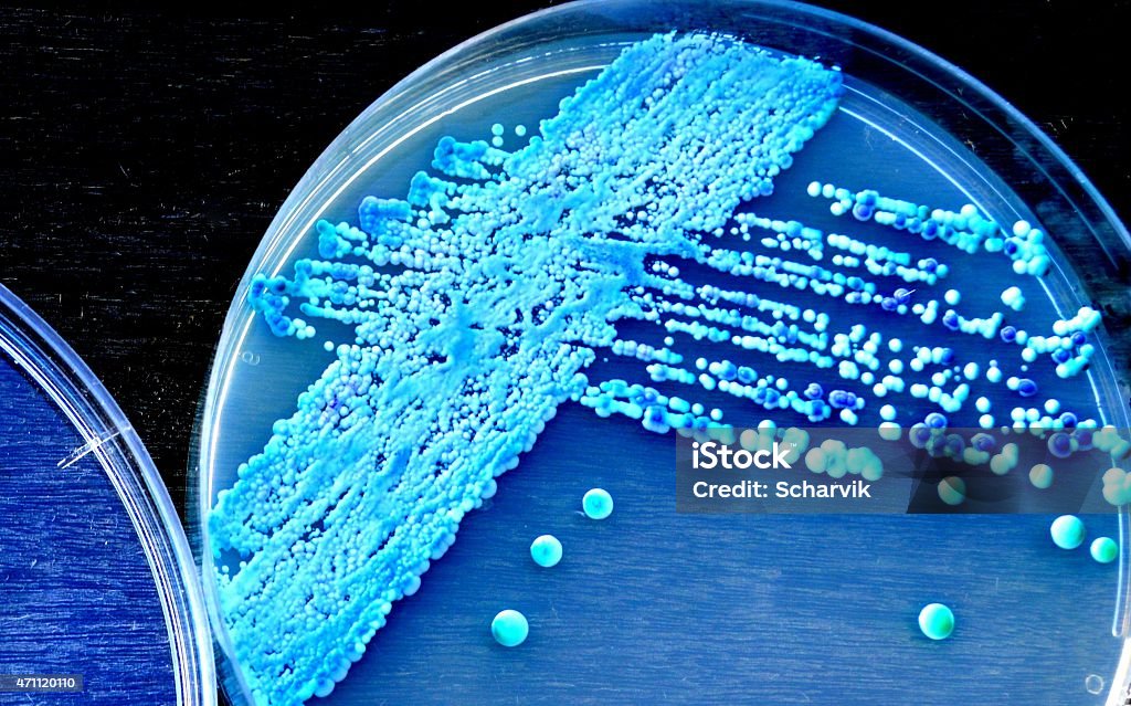 Yeast Candida spp. grown on a chrome agar plate. Thrush - Yeast Infection Stock Photo