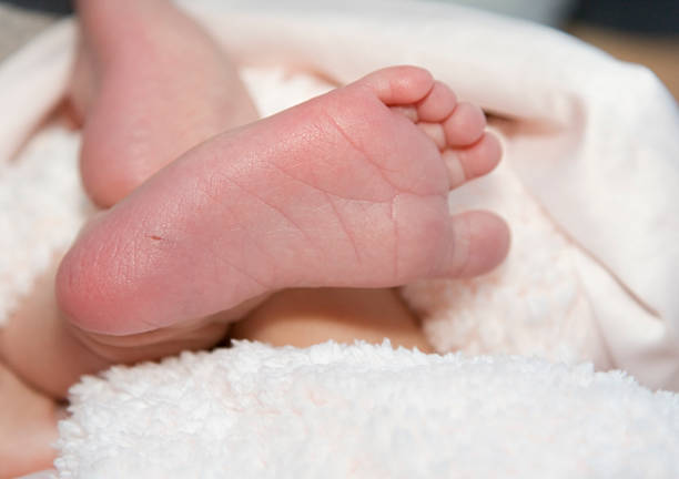 Newborn Infant Sole of Foot, Child, Phenylketonuria (PKU) Test stock photo