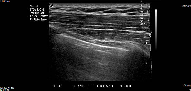 Ecografia del seno - foto stock