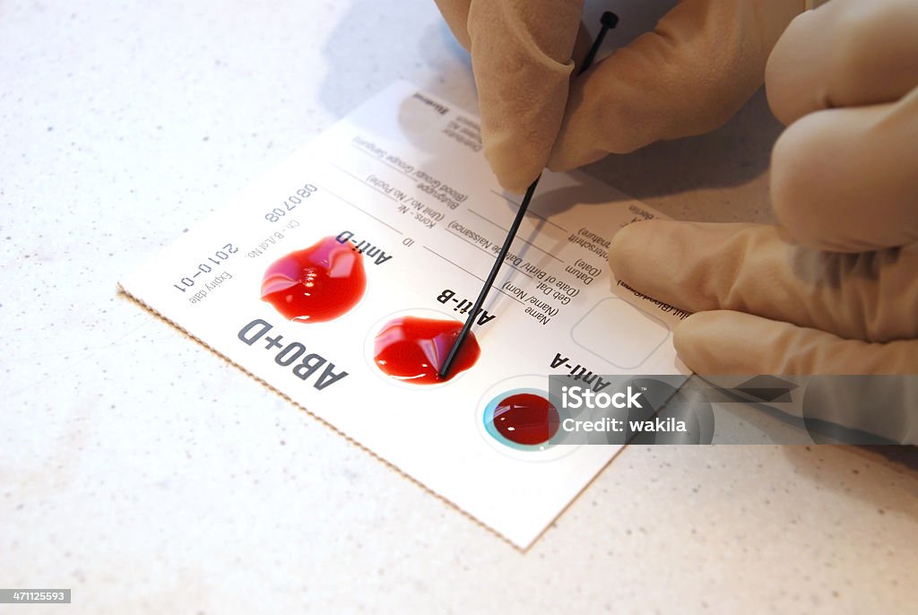 유혈 group 테스트-Blutgruppentest - 로열티 프리 혈액형 스톡 사진