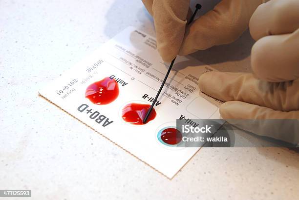 유혈 Group 테스트blutgruppentest 혈액형에 대한 스톡 사진 및 기타 이미지 - 혈액형, 과학 실험, 건강 진단