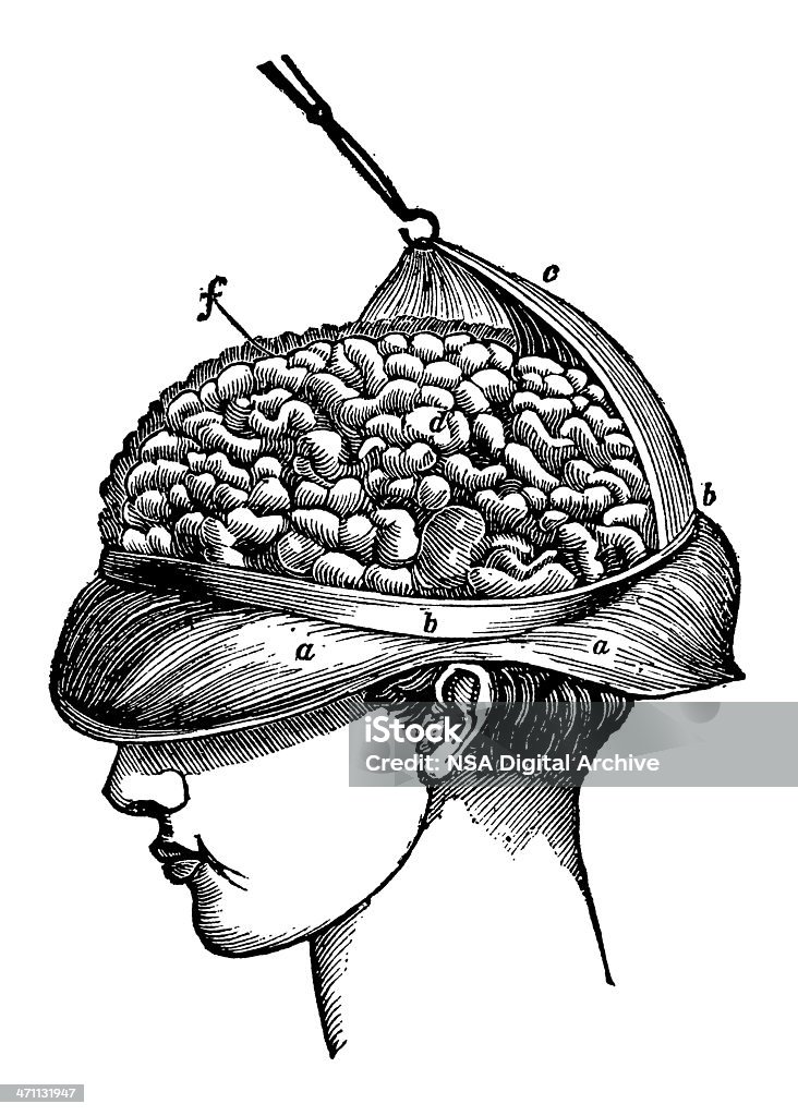 Cirugía cerebral (Aislado en blanco - Ilustración de stock de Culto libre de derechos