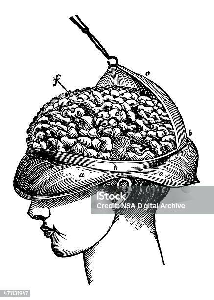 Vetores de Cirurgia Cerebral Isolado No Branco e mais imagens de Culto - Culto, Criatividade, Estilo retrô