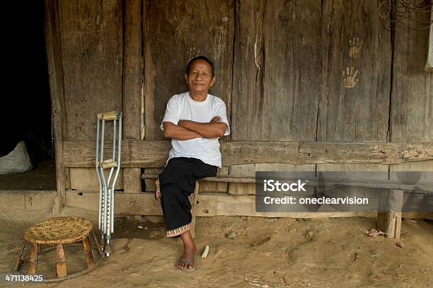 Meo족 오하이오 목발에 대한 스톡 사진 및 기타 이미지 - 목발, 절단 수술을 받은 사람, Meo족