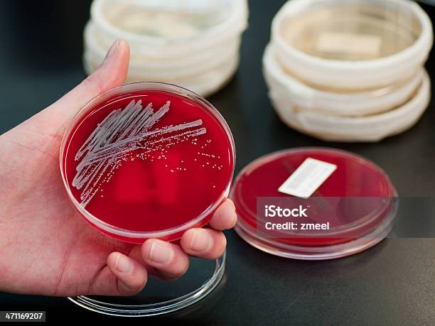 박테리아 문화 MRSA에 대한 스톡 사진 및 기타 이미지 - MRSA, 황색포도상구균, 박테리아