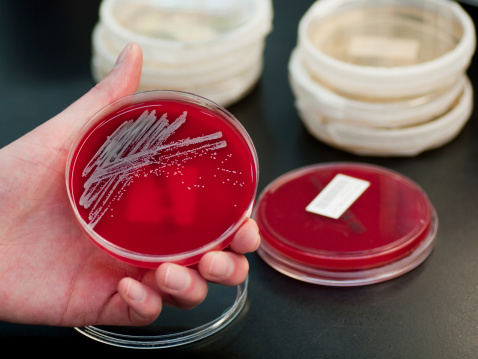 A hand holding a culture of Staphylococcus aureus on a jelly agar.