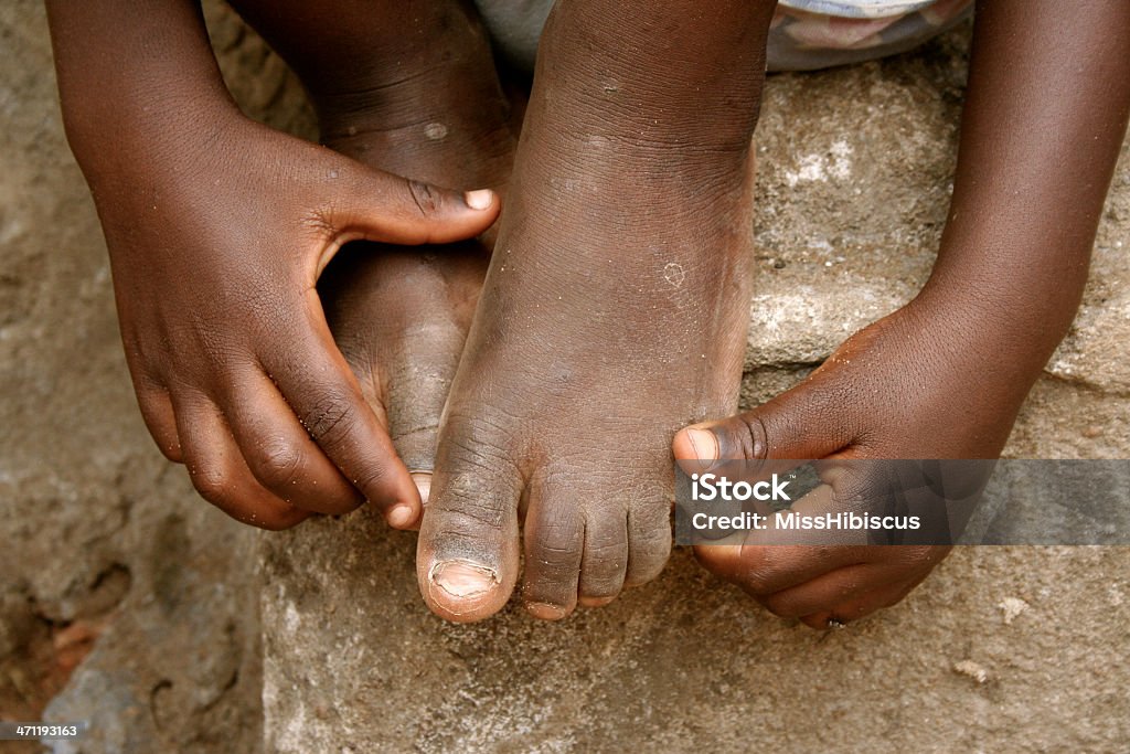 African enfant les mains et les pieds - Photo de Action caritative et assistance libre de droits