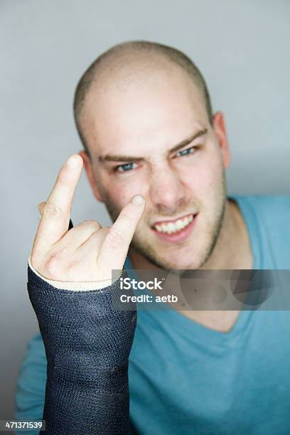 Young Adult With Broken Arm Stock Photo - Download Image Now - Men, Rock Music, 20-24 Years