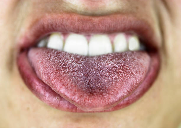 istock Mouth with wide open tongue 471386351