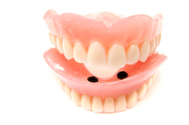 istock Dental implant model 471388803
