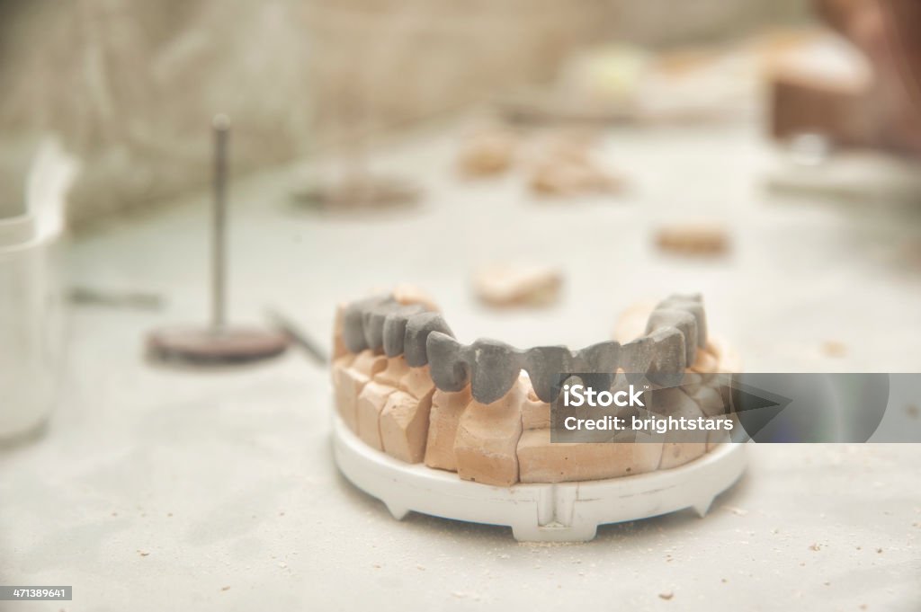 Dental prosthesis - Lizenzfrei Arbeitsstätten Stock-Foto