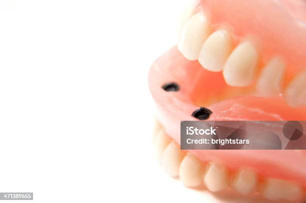 歯のインプラントモデル - カットアウトのストックフォトや画像を多数ご用意 - カットアウト, クローズアップ, スタジオ撮影