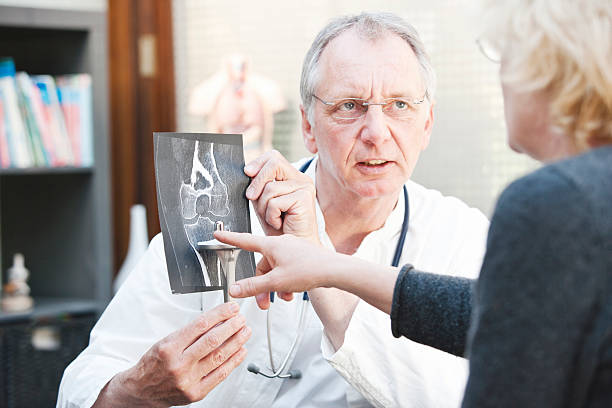 médecine mature présentation de x-ray et le genou de patients arthroplasty pour femme - x ray human knee orthopedic equipment human bone photos et images de collection