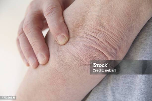 Man With A Sore Elbow Stock Photo - Download Image Now - Adult, Anatomy, Arthritis