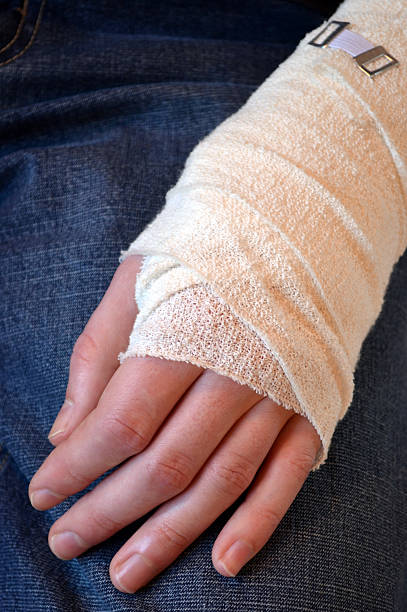 Male with Broken Arm stock photo