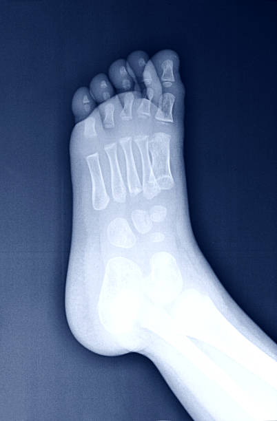 imagerie par rayons x des pieds. - bending human foot ankle x ray image photos et images de collection