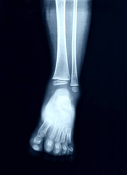 x-ray image des fußes. - bending human foot ankle x ray image stock-fotos und bilder