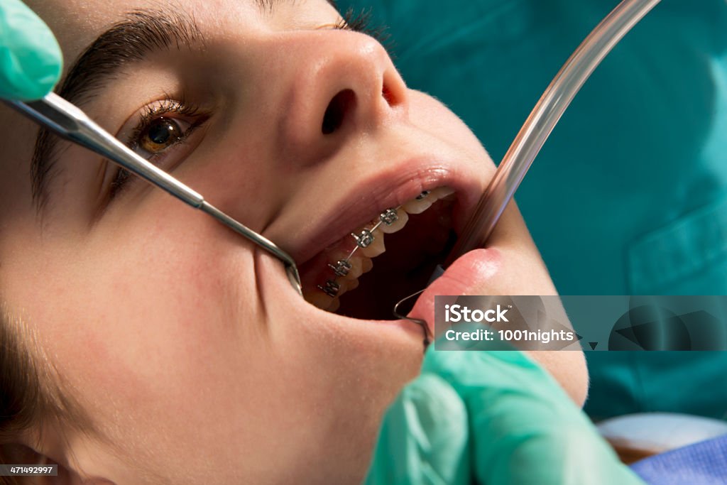 Zahnärztlichen Behandlung - Lizenzfrei Allgemeine Beschaffenheit Stock-Foto