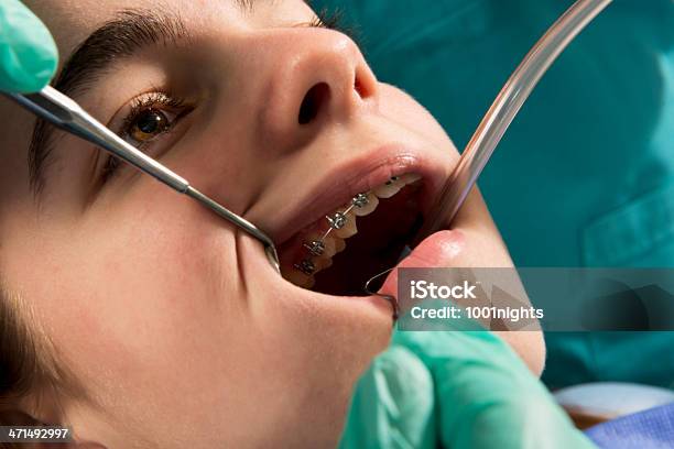 Trattamento Dentale - Fotografie stock e altre immagini di Abbigliamento - Abbigliamento, Adulto, Ambulatorio dentistico