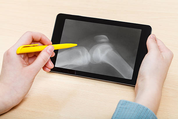 étudiant analyse genou humain-joint sur une tablette pc - doctor human knee human leg medical exam photos et images de collection