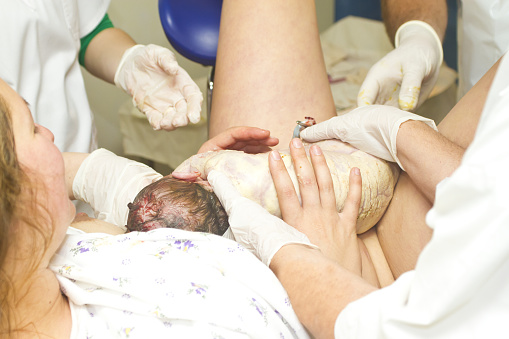 woman giving birth to a baby in a hospital